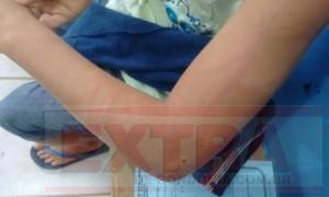 CRUELDADE: Garoto de 11 anos é roubado, amarrado em carrinho de picolé e jogado em buraco