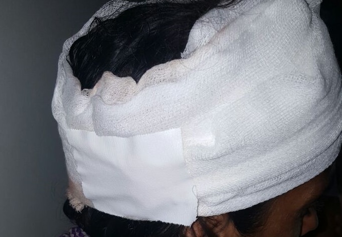 Marido ataca esposa por causa de cachaça