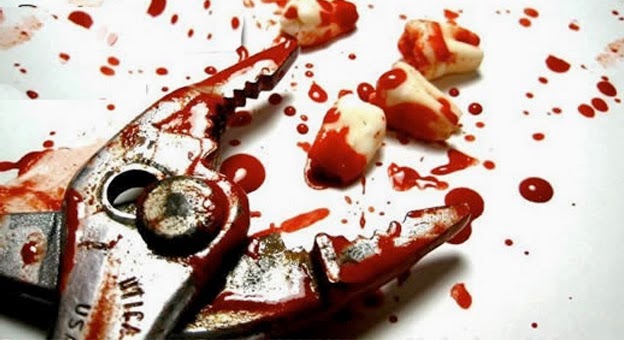 COVARDE: Marido tortura mulher arrancando dentes e dando facadas