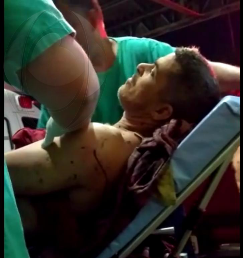 Sitiante atira no próprio corpo durante caçada