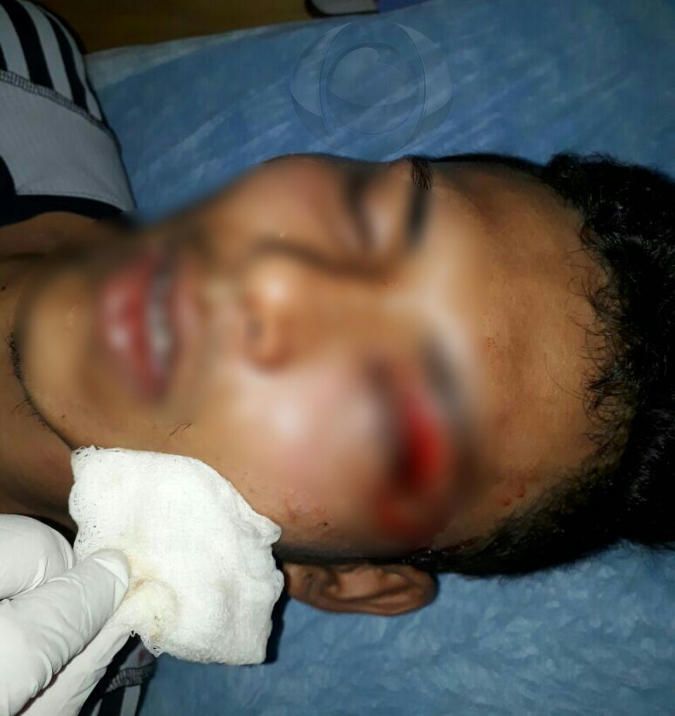 Jovem leva facada no olho em suposta tentativa de assalto