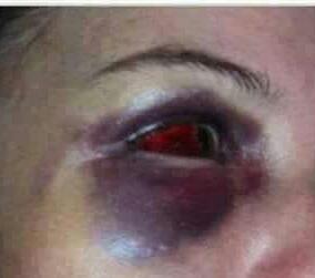 Após flagrar marido com outra, mulher é surrada por atender ligação de amigo