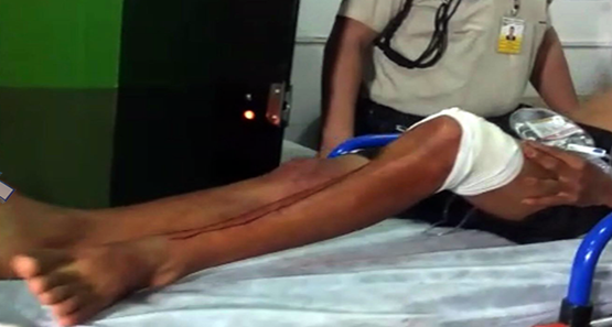 Adolescente de 15 anos é baleado ao sacar arma durante fuga