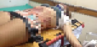 VÍTIMA SAI DA FESTA E SOFRE EMBOSCADA, ELA FOI ATINGIDA POR DUAS PERFURAÇÕES À FACA.