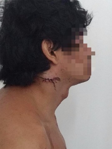 Incentivado pelo companheiro, alvo de operação da PF contra pornografia infantil tenta se matar