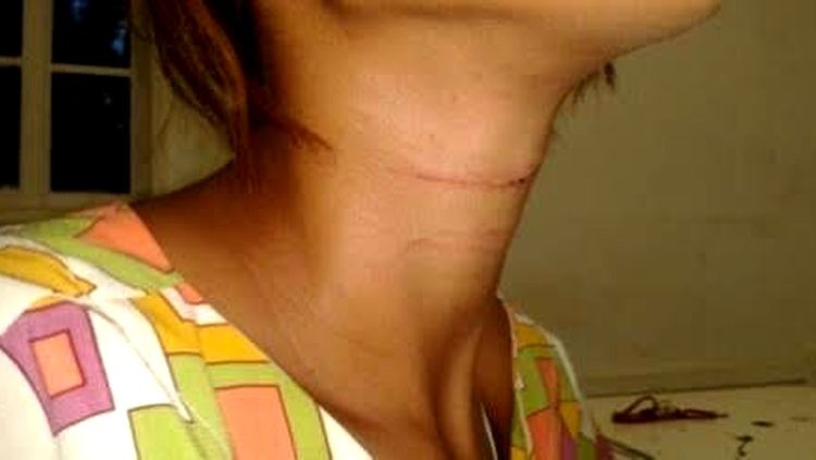 DESESPERO: Marido é preso tentando matar mulher a facadas dentro de residência