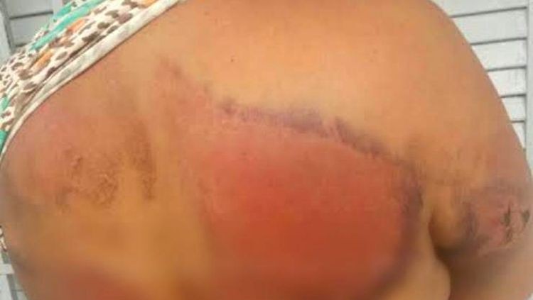 Filha impede que mãe seja morta a golpes de facão pelo padastro