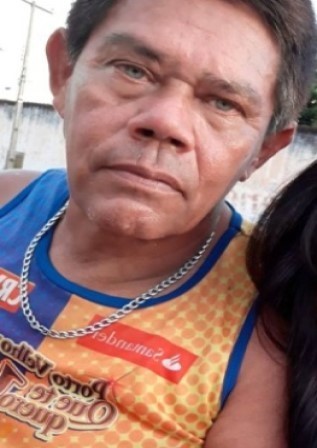 PAULÃO “O PINTOR AMIGÃO” TEM PERNA FRATURADA E DILACERADA EM ACIDENTE GRAVE EM GUAJARÁ-MIRIM.