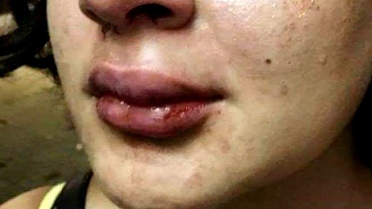 SURRADA: Jovem é espancada por chamar mulher de gorda na zona leste da capital