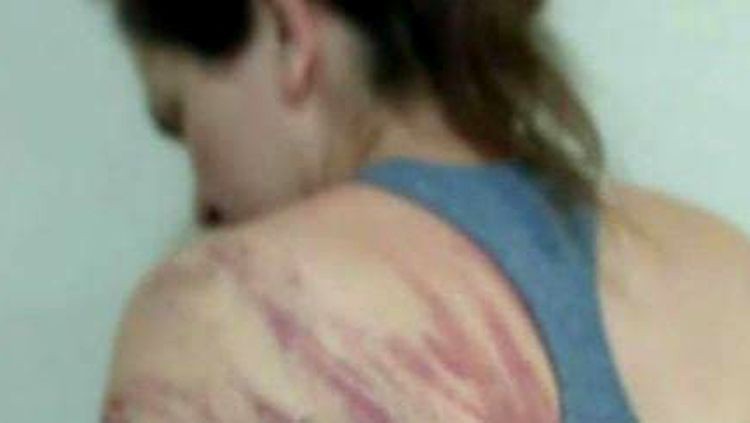 ESPANCADA: Dona de casa leva surra de fio elétrico e pauladas ao discutir com marido.