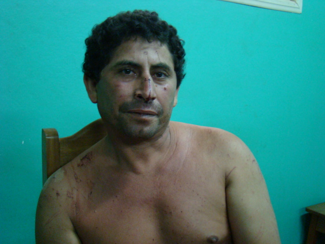 Homem que matou mulher é preso por populares na Bolívia e apresentado à Polícia brasileira