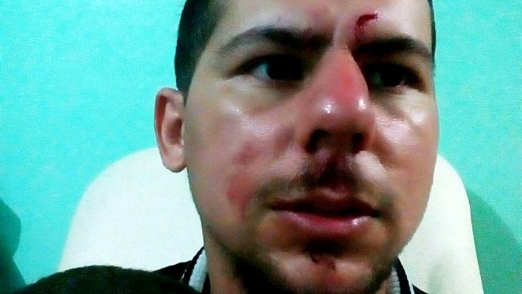 TRAGÉDIA NA 364: Sobrevivente de acidente entre ônibus e carreta conta como tudo aconteceu