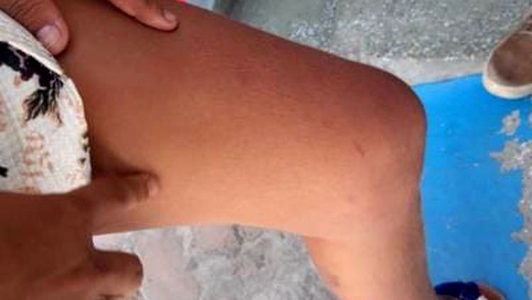 HORROR: Adolescente é sequestrada por trio encapuzado e estuprada em cativeiro