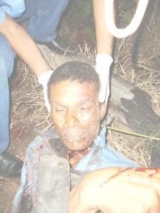 IMAGENS FORTES- Com um golpe de foice homem arranca a cabeça de outro em zona rural de Pimenta Bueno