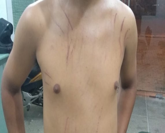 Marido é surrado por questionar mulher que chegou em casa bêbada