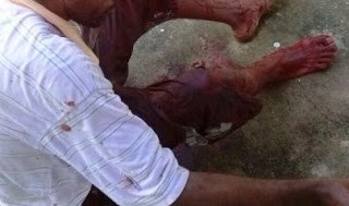 Homem se nega a pagar por programa sexual e é agredido a terçadadas por mulher no bairro Santa Luzia