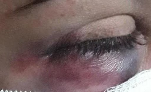 Mulher chega em casa de madrugada e acaba espancada pelo marido