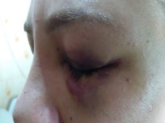 Ex-namorado foge depois de surrar jovem que aguardava consulta médica em posto