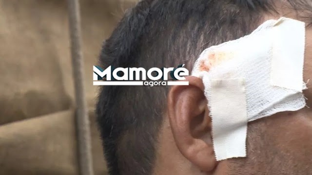 HOMEM É BALEADO NA CABEÇA POR SE NEGAR A PAGAR CERVEJA PARA DESCONHECIDO E SÓ DESCOBRE DOIS DIAS DEPOIS
