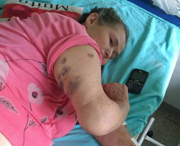 ABANDONO – Em RO, idosas choram e denunciam que dividem quarto com ratos e baratas em hospital; rapaz acidentado acabou perdendo parte da perna por falta de médico