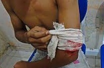 Adolescente de 13 anos é baleado enquanto caminhava no bairro Jardim das Esmeraldas em Guajará-Mirim