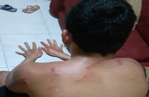 Homem leva surra de ex-mulher em Porto Velho