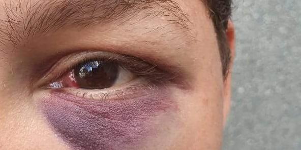 Mulher perde filho após ser agredida pelo marido na capital