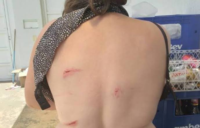 Mulher tem três costelas e dente quebrados pelo marido ao ser espancada