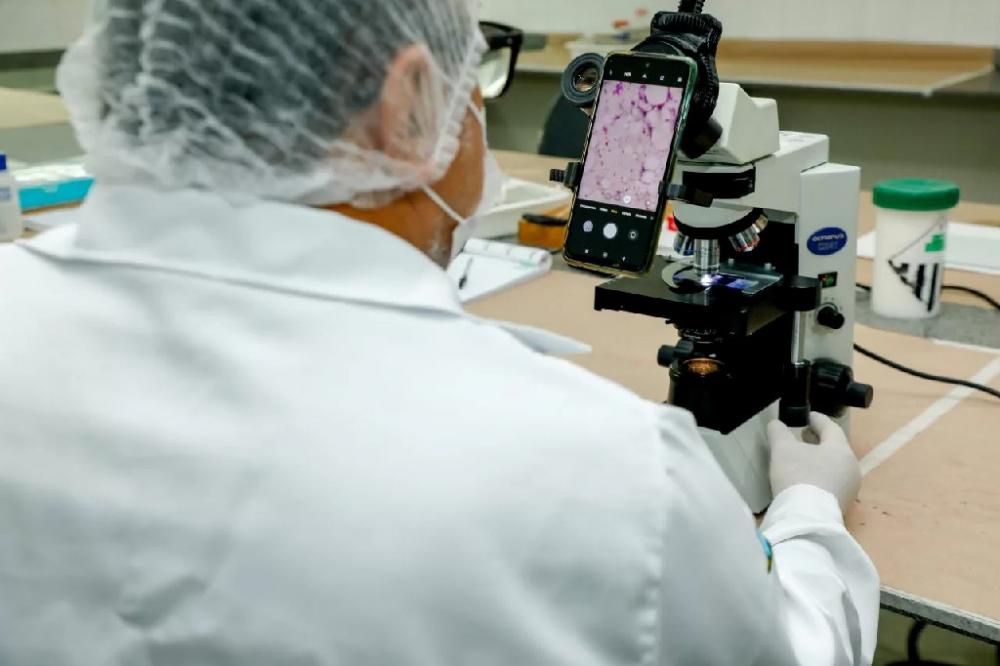 Exames para diagnóstico da Doença de Chagas são realizados no Lacen, em Rondônia