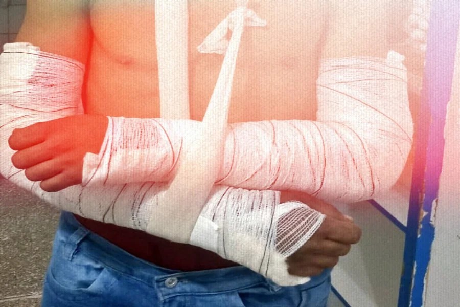 Casal é preso suspeito de torturar e quebrar braços de homem em Porto Velho