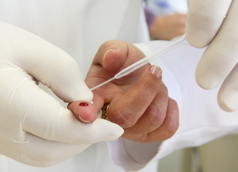 Casos de sífilis e de HIV/aids aumentam entre homens jovens