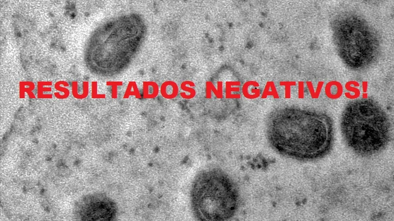 CASOS SUSPEITOS DE MPOX EM GUAJARÁ-MIRIM SÃO DESCARTADOS APÓS ANÁLISE LABORATORIAL