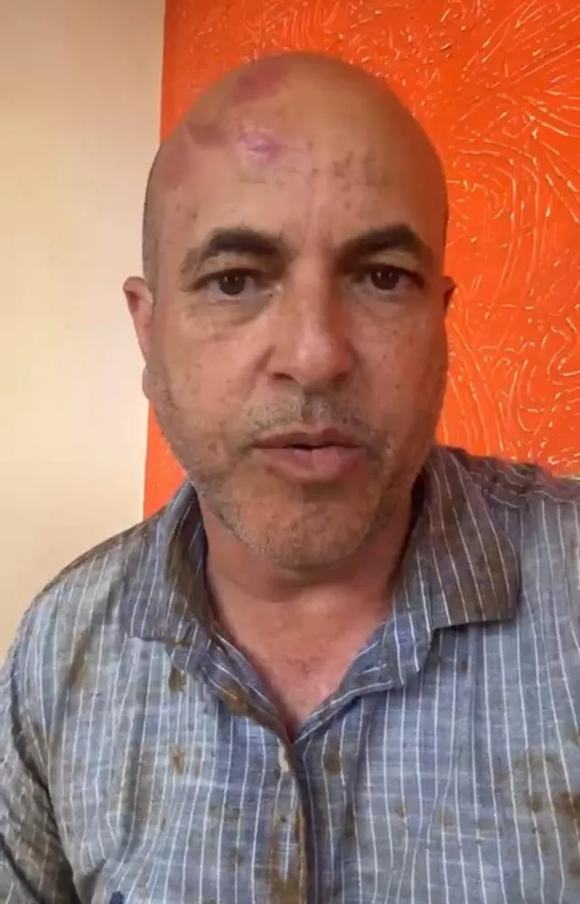 VEREADOR TRANQUILIZA POPULAÇÃO APÓS ACIDENTE ENVOLVENDO DEPUTADO ESTADUAL NA BR-429