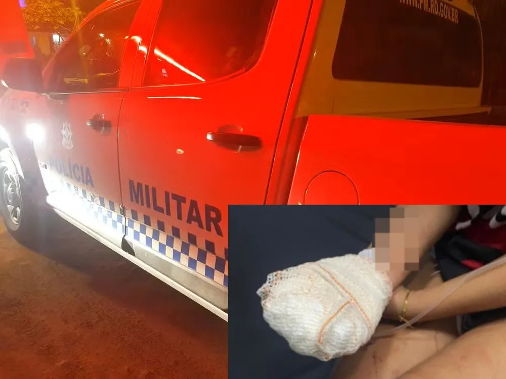 MULHER TEM DEDO AMPUTADO APÓS AGRESSÃO DURANTE CASO DE VIOLÊNCIA DOMÉSTICA EM GUAJARÁ-MIRIM