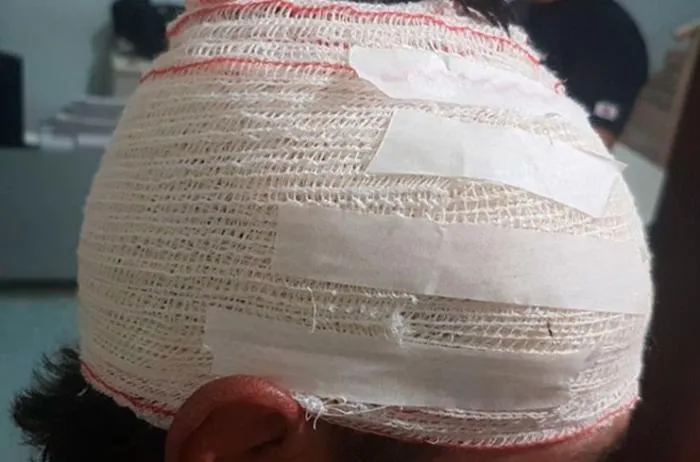 HOMEM FICA FERIDO NA CABEÇA E CAUSA TUMULTO DURANTE CONFRATERNIZAÇÃO EM NOVA MAMORÉ