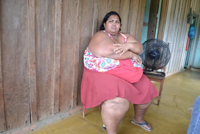 Mulher que pesa mais de 200 kg pede ajuda para realizar cirurgia de redução de estômago - Fotos