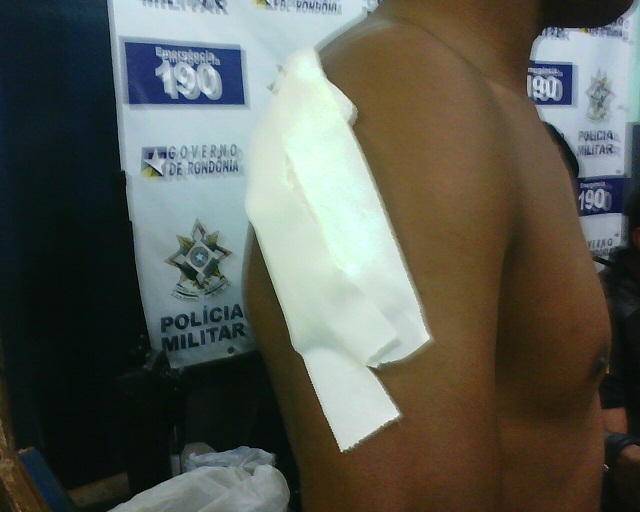 Agente penitenciário é ferido a bala e reage assalto no bairro Planalto. Fotos