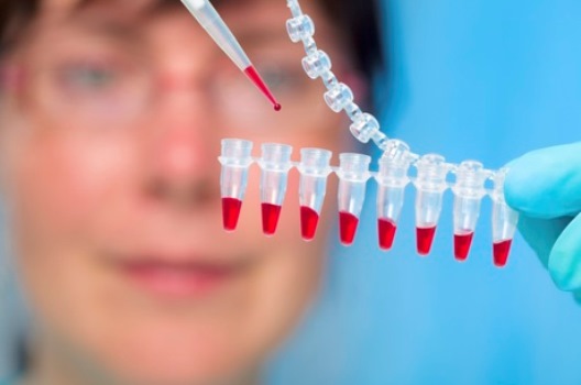 Brasileiros desenvolvem vacina que promete amenizar tratamento contra Aids