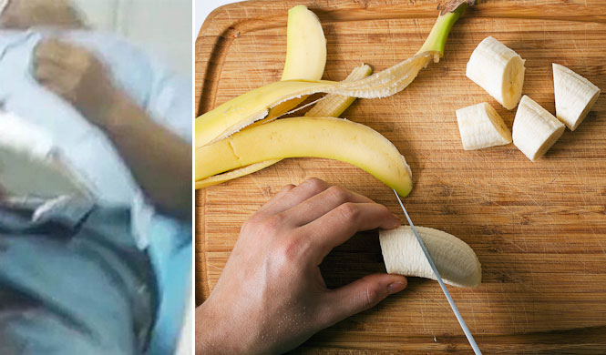 Homem corta o órgão genital após namorada dizer que ele é ruim de cama